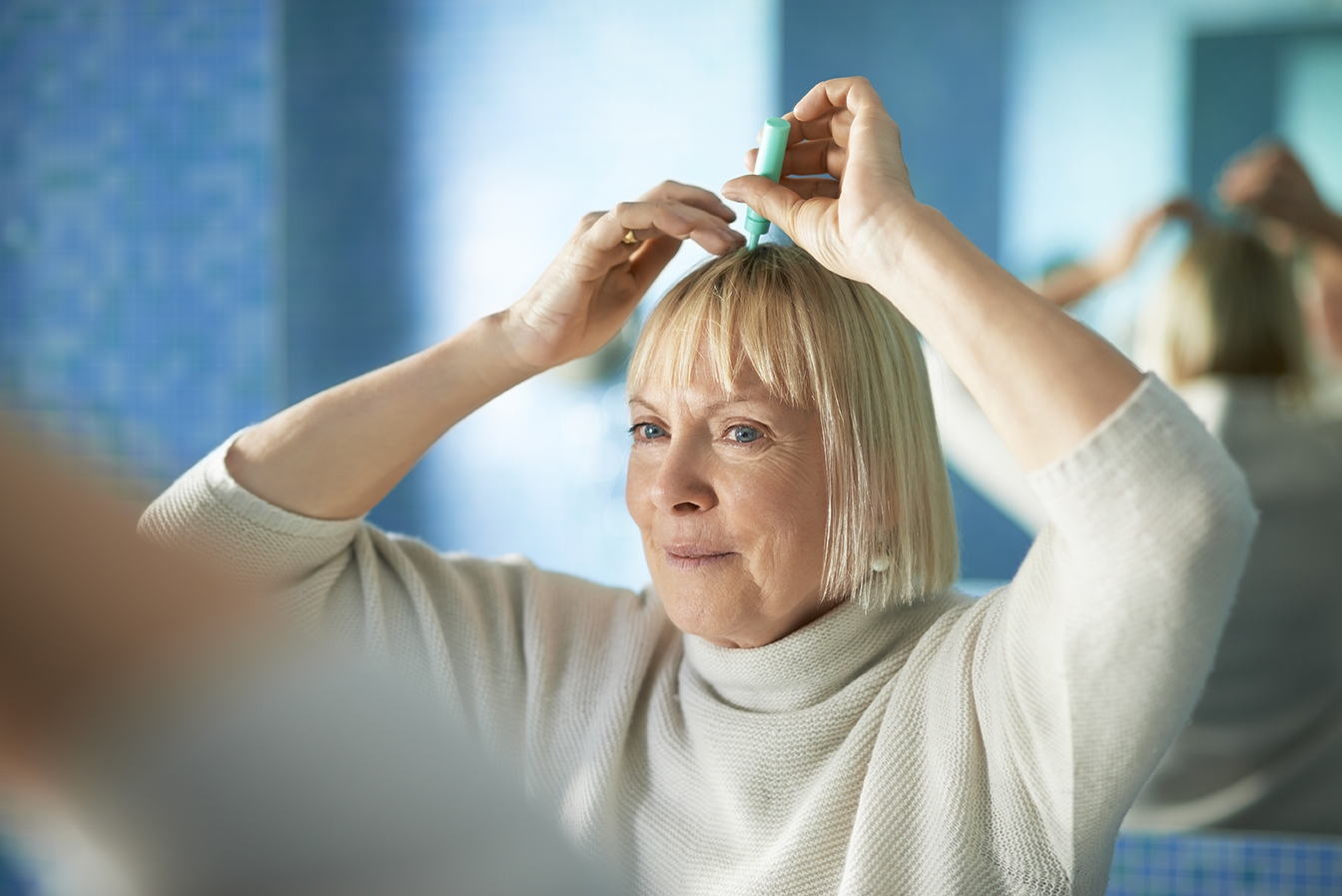 Hair losss Treatment at Hair Restoration Savannah