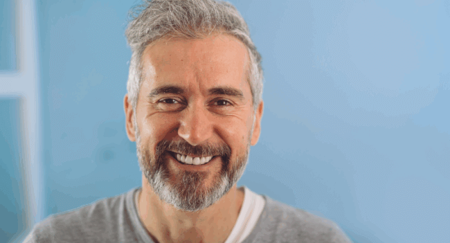 Natural hair growth after NeoGraft hair transplant Savannah
