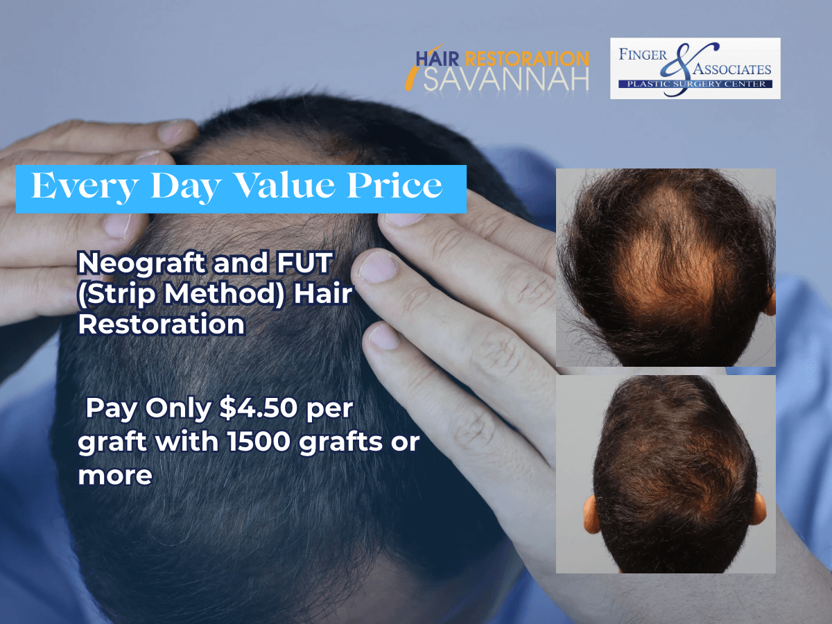 Hair Restoration Special at Hair Restoration Savannah