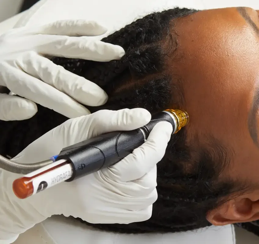 Scalp Cleansing with Keravive by HydraFacial at Hair Restoration Savannah, GA