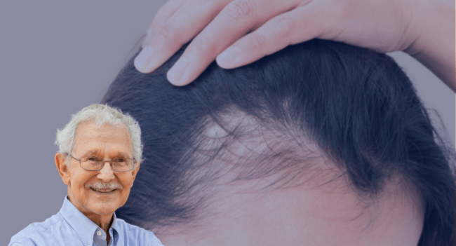 Hair Restoration and Hair Growth Focused Care in Savannah, GA