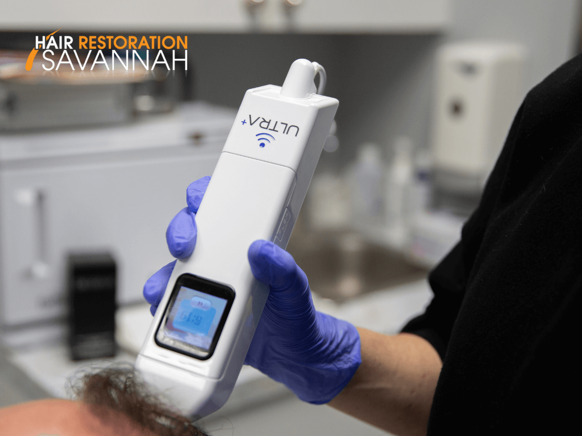 Ultra Plus at Hair Restoration Savannah in Savannah. GA