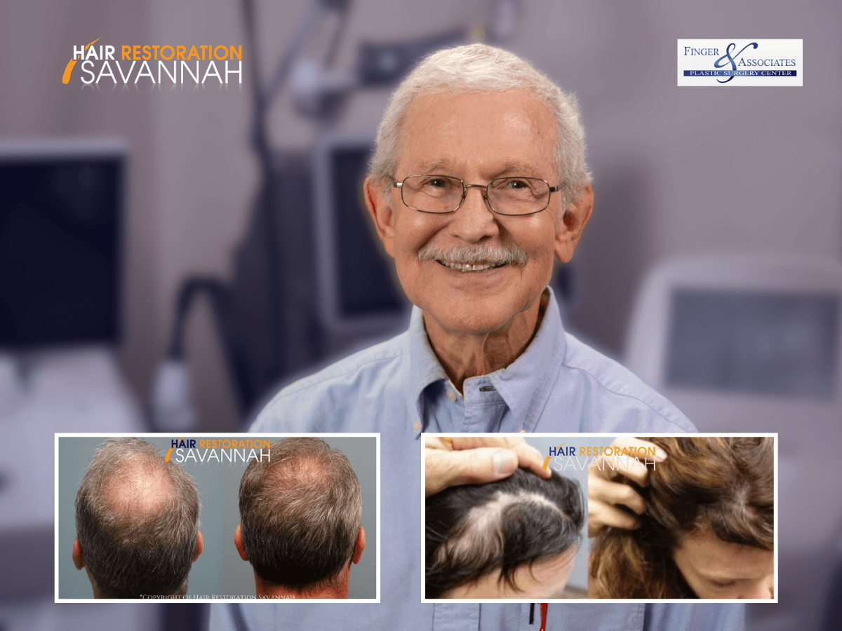 Hair growth solutions at Hair Restoration Savannah in Savannah GA